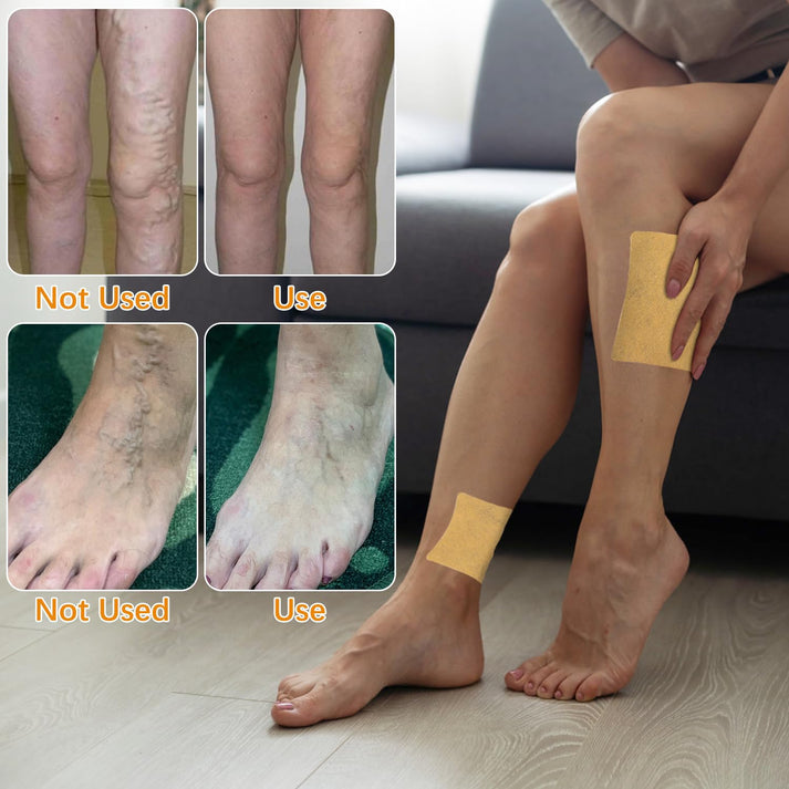 VariCose™ - Instant Relief Varicose Vein Patches (Pack of 20)