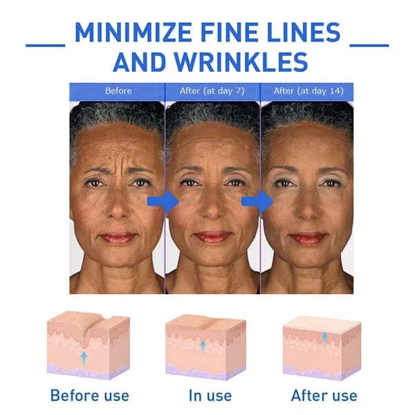 Botox Anti-Aging Serum (Buy 1 Get 1 Free 🔥🔥)