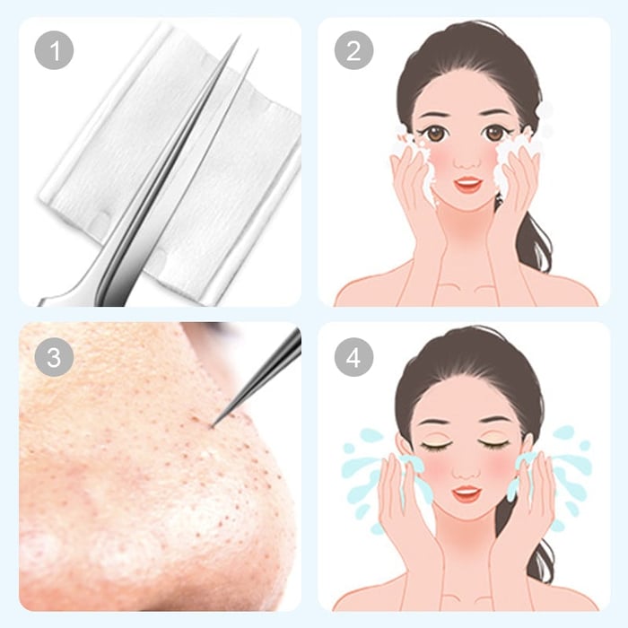 🔥HOT SALE 49% OFF-Stainless Steel Blackhead Remover Tool Kit