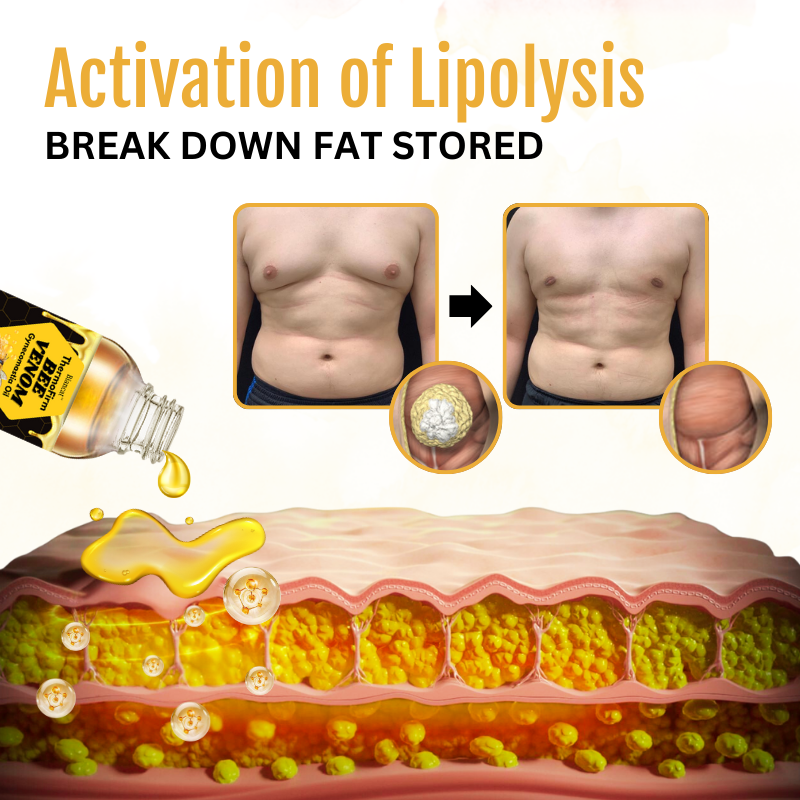 Bee Venom Gynecomastia Oil - Buy 1 Get 1 Free 🤩