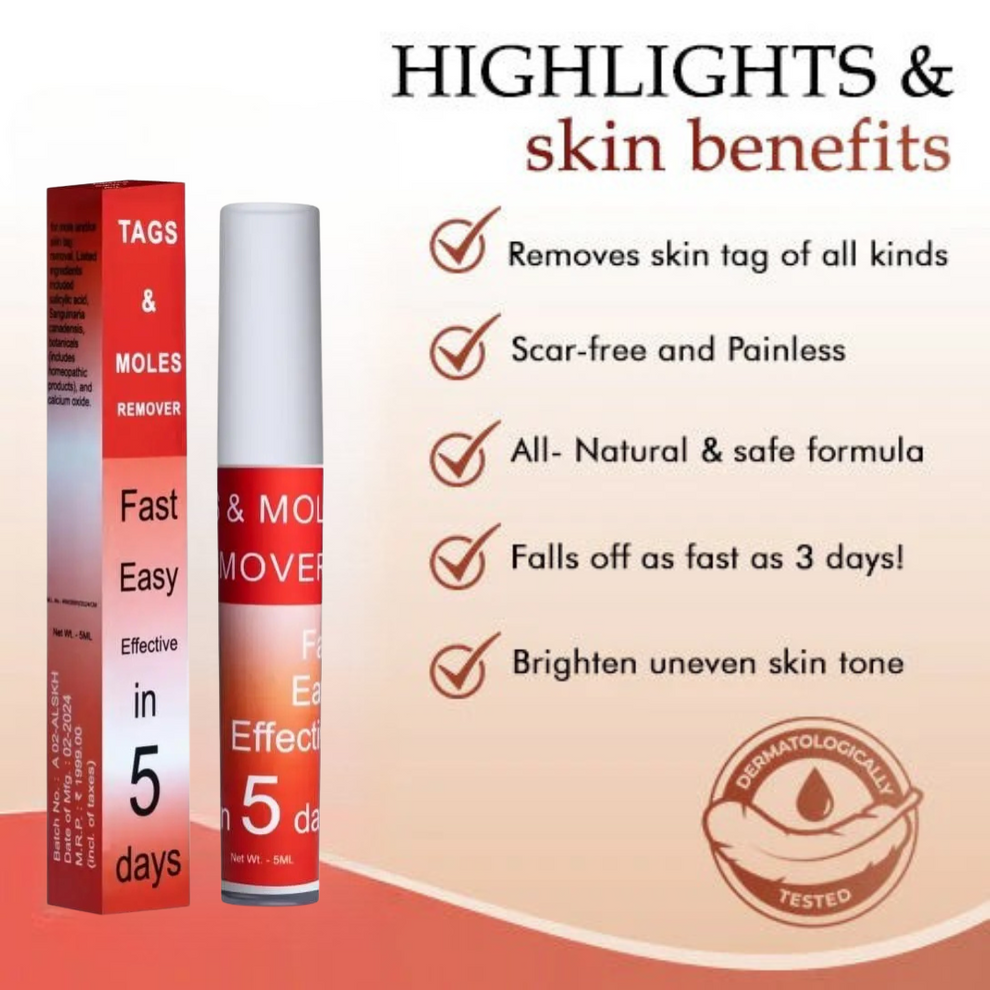 LOVILDS™ Tags & Moles Remover (Buy 1 Get 1 Free 😍)