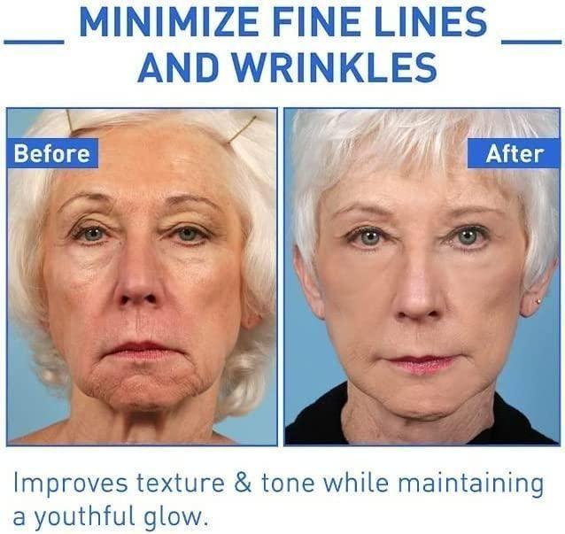 Botox Anti-Aging Serum (Buy 1 Get 1 Free 🔥🔥)