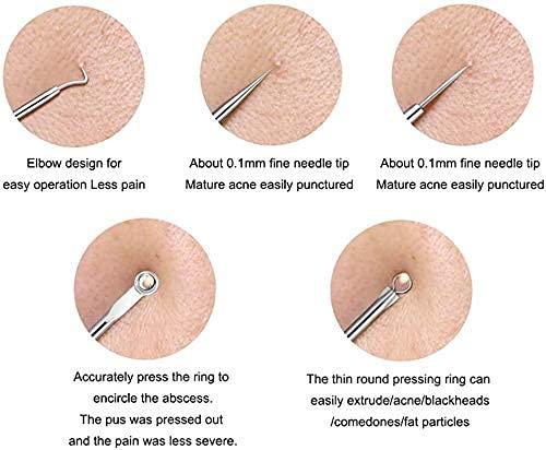 🔥HOT SALE 49% OFF-Stainless Steel Blackhead Remover Tool Kit