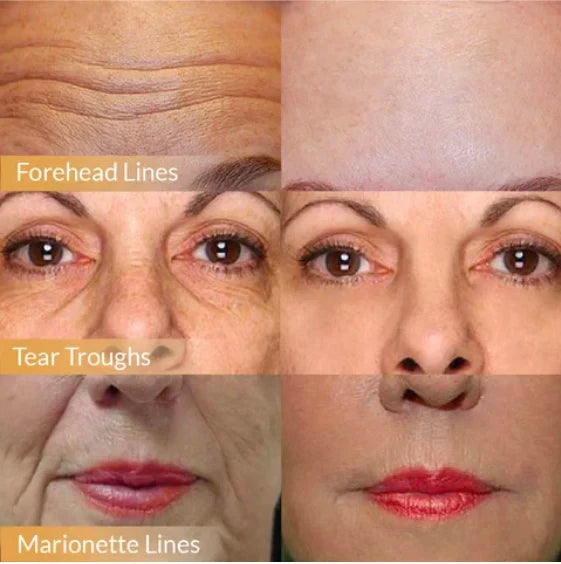 POLYPEPTIDE FIRMING FULL FACE CREAM (️‍🔥Buy 1 Get 1 Free️‍🔥)