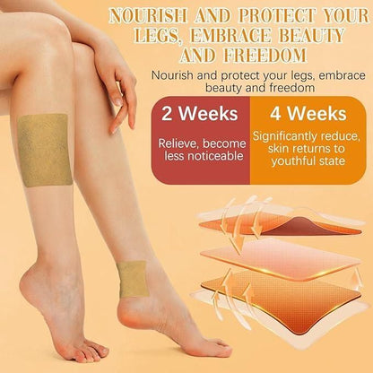 VariCose™ - Instant Relief Varicose Vein Patches (Pack of 20)