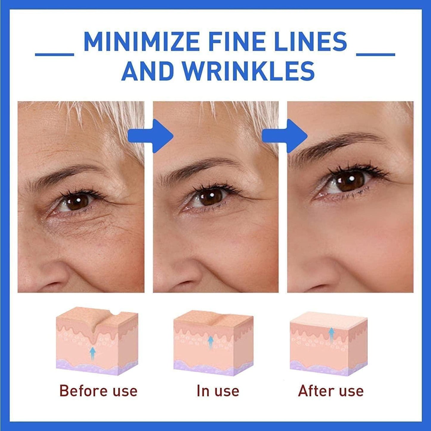 Botox Anti-Aging Serum (Buy 1 Get 1 Free 🔥🔥)