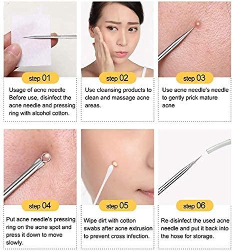 🔥HOT SALE 49% OFF-Stainless Steel Blackhead Remover Tool Kit
