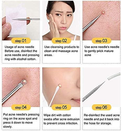 🔥HOT SALE 49% OFF-Stainless Steel Blackhead Remover Tool Kit