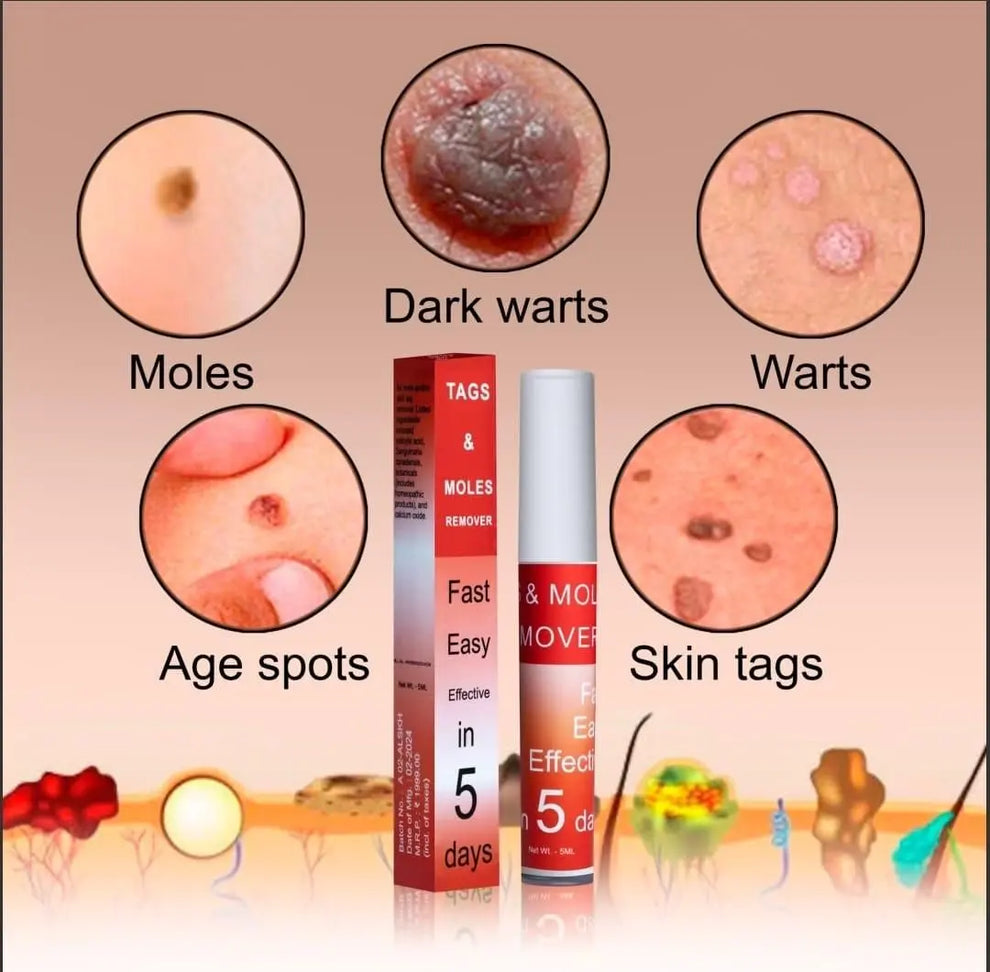 LOVILDS™ Tags & Moles Remover (Buy 1 Get 1 Free 😍)