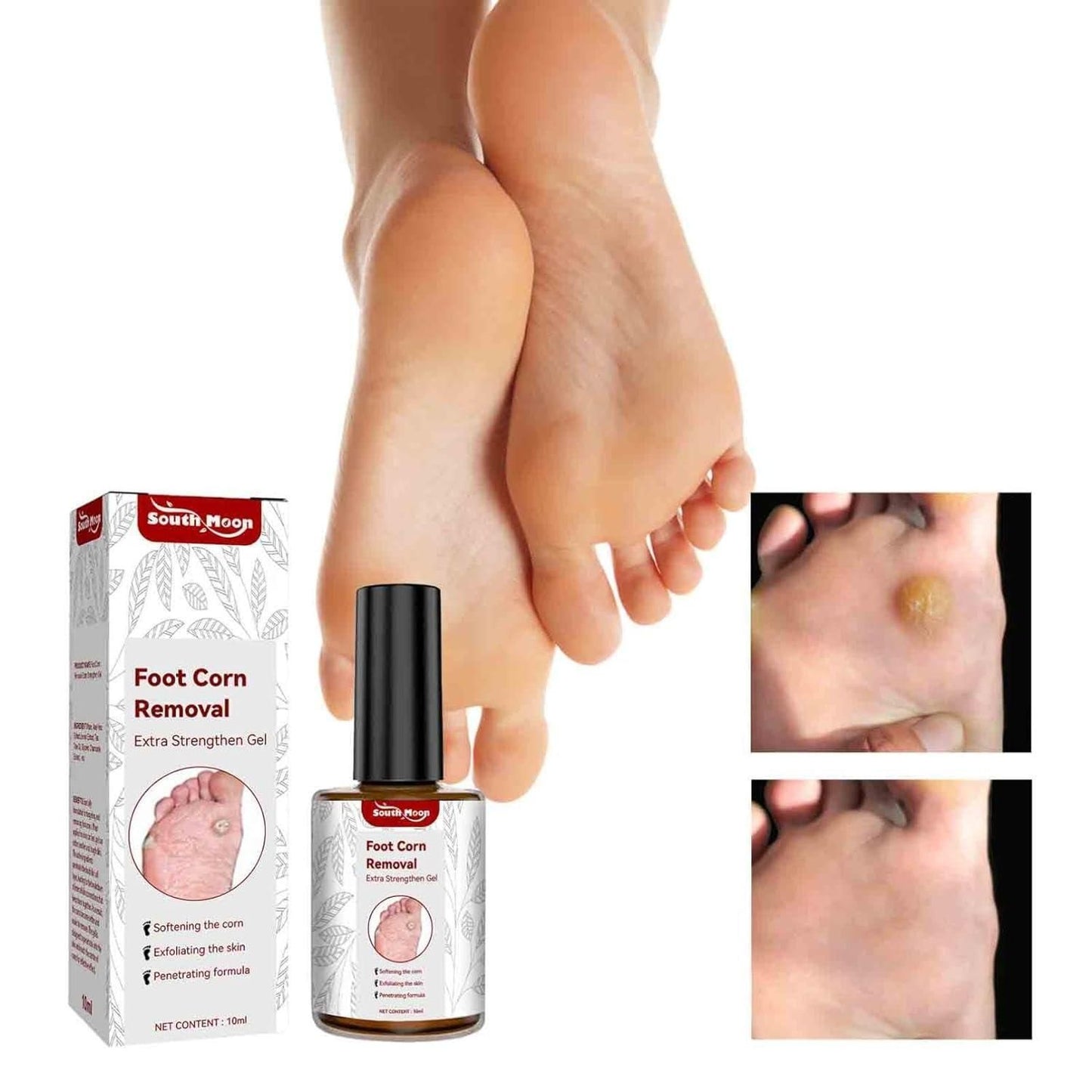Ultimate Feet Corn Removal Serum - Dr. Recommended