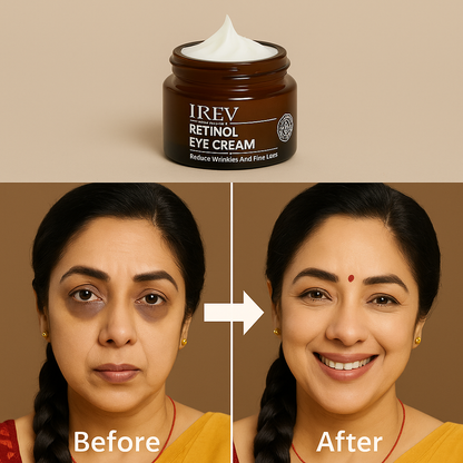 Retinol Eye Cream (Buy 1 Get 1 Free 🔥🔥)