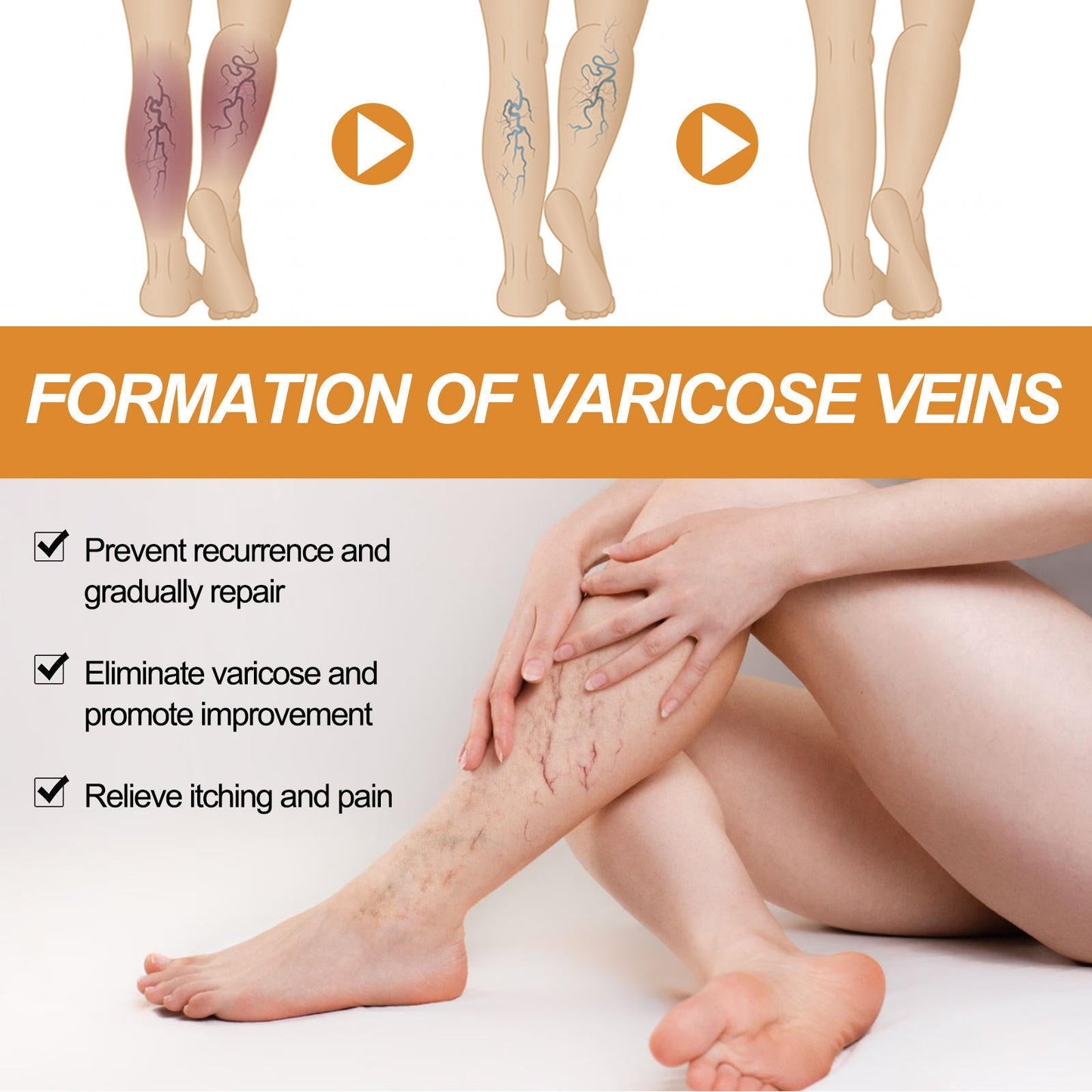 Varicose Vein Relief Spray