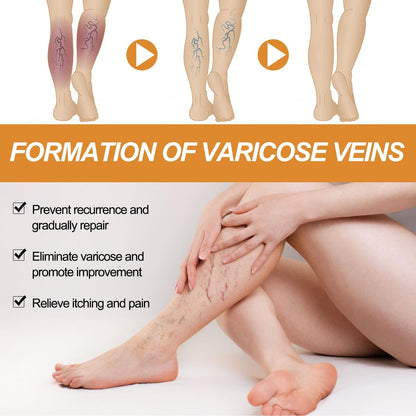 Varicose Vein Relief Spray