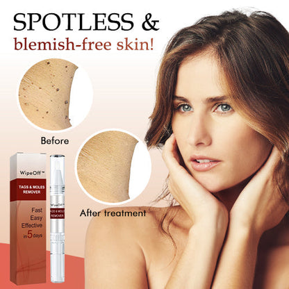 Derma Smooth Skin Tag Removal Patch🌟 (Buy 1 Get 1 Free 😍)