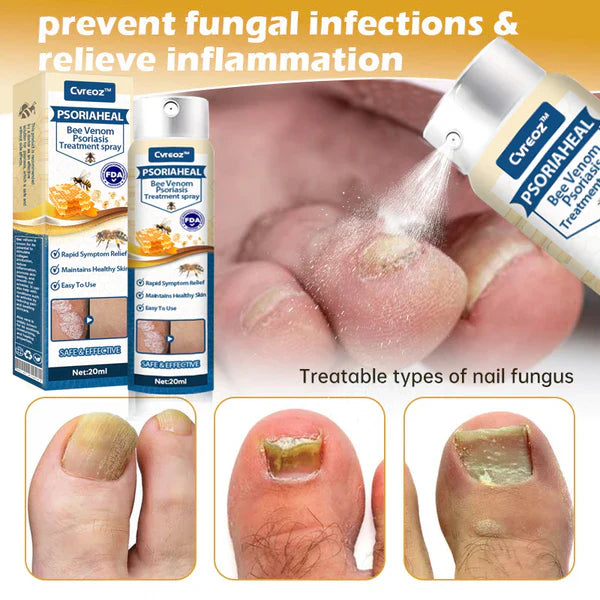 Premium PsoriaHeal Bee Venom Psoriasis Treatment Spray 📣 Recommended by Experts 👩‍⚕️