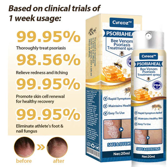 Premium PsoriaHeal Bee Venom Psoriasis Treatment Spray 📣 Recommended by Experts 👩‍⚕️