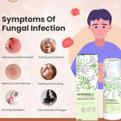 Ecze+ Anti Fungal Spray (Buy 1 Get 1 Free 🔥🔥)