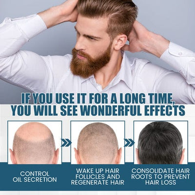GreGon Anti-Greying Hair Serum