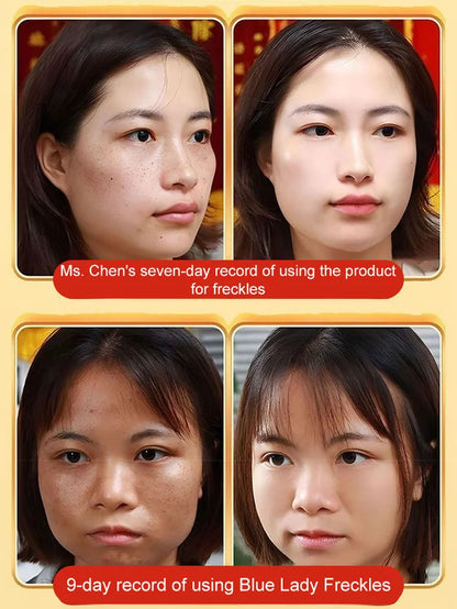 Spot Removing And Whitening Beauty Water