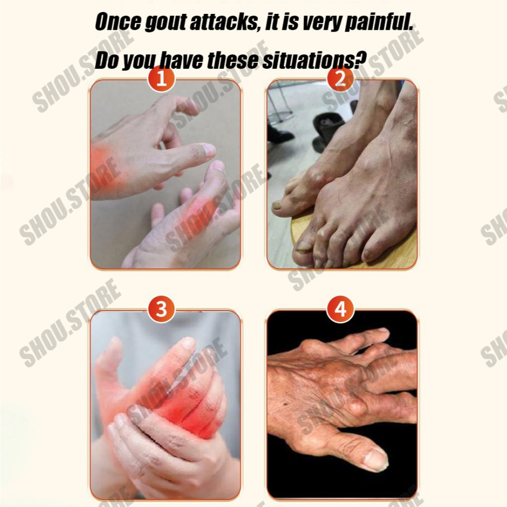 Japan Gout Care Patch Quick Pain Relief ( BUY 1 GET 1 FREE )