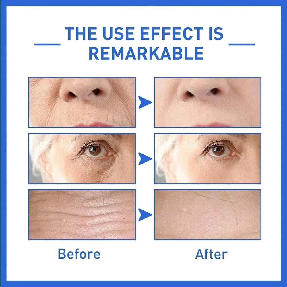 Botox Anti-Aging Serum (Buy 1 Get 1 Free 🔥🔥)