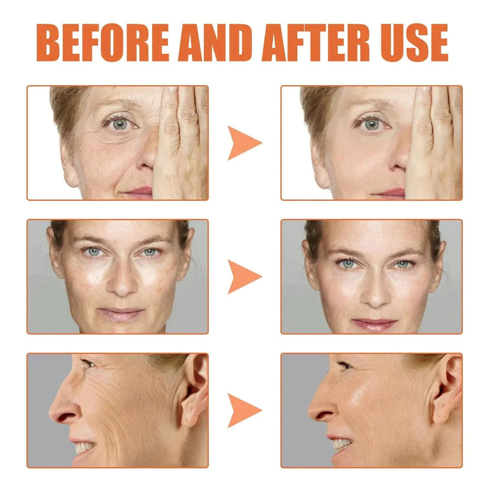 Botox Anti-Aging Serum (Buy 1 Get 1 Free 🔥🔥)