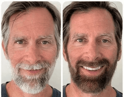 GreGon Anti-Greying Hair Serum