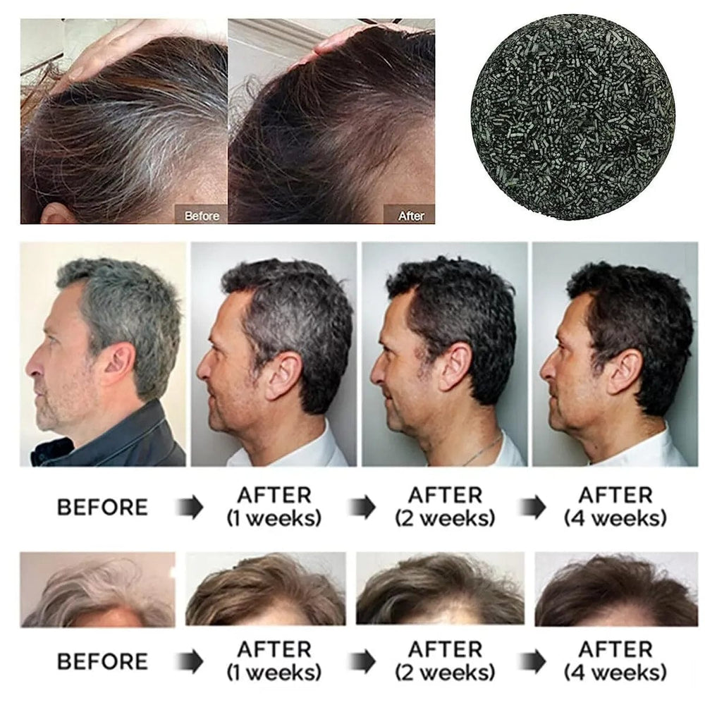 GreGon Anti-Greying Hair Serum